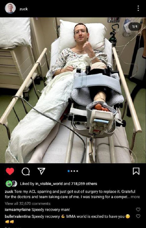 扎克伯格因韧带撕裂住院 